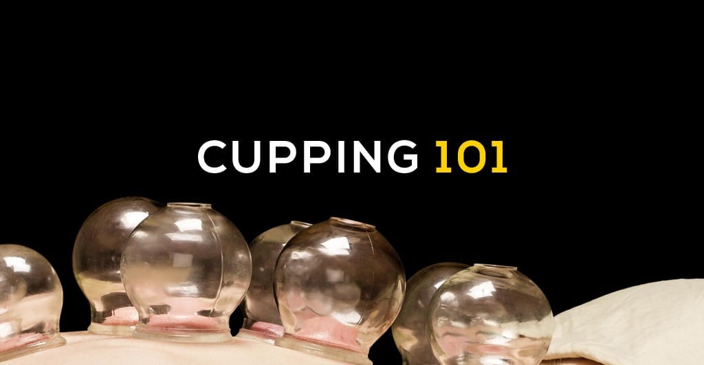 All you need to know about Ba Guan (Cupping)