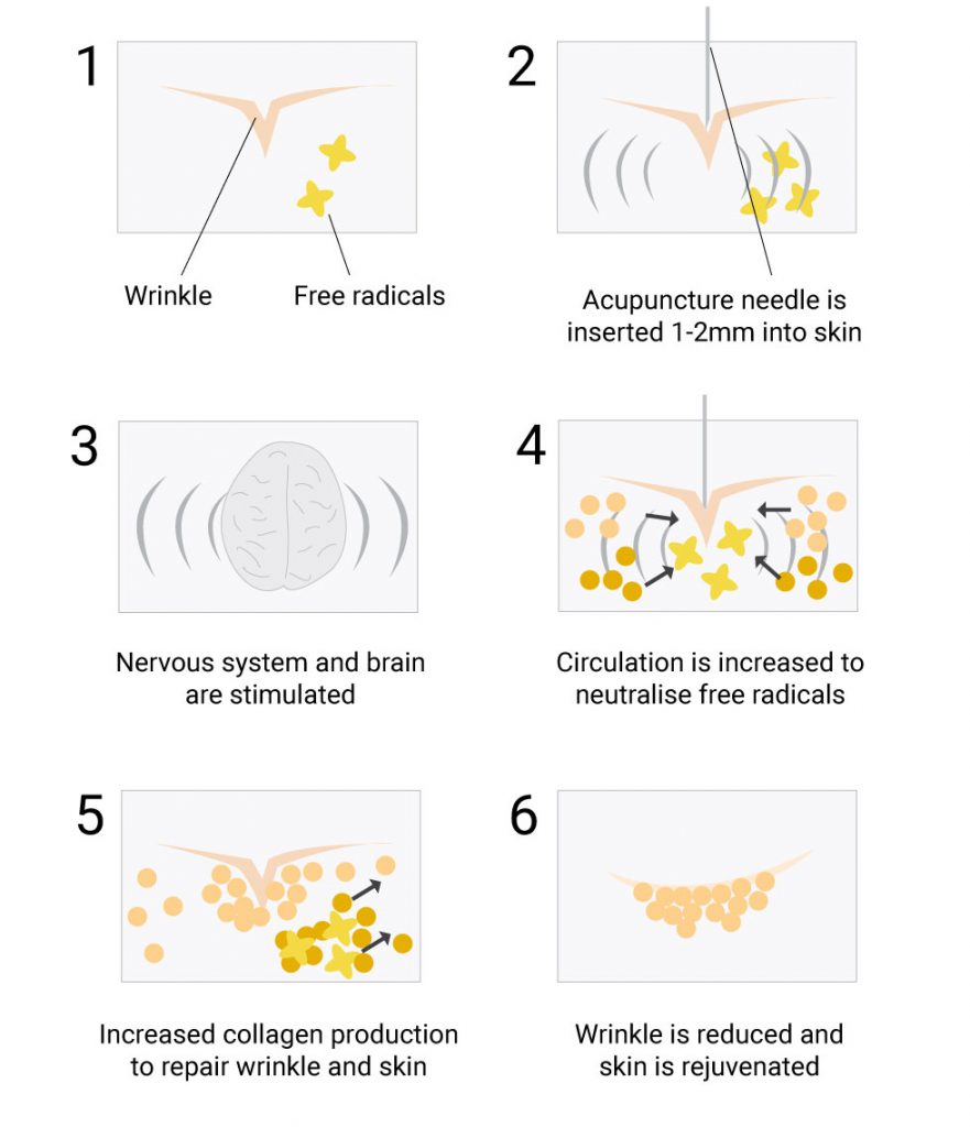 wrinkle-diagram