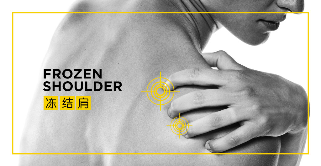 Frozen_Shoulder_1