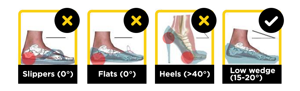 Common Causes of Heel Pain and Plantar Fasciitis