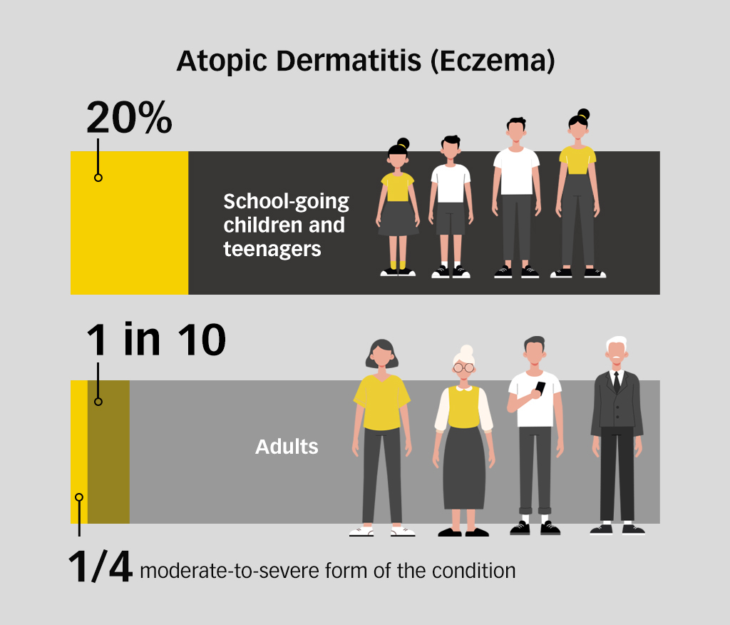 Eczema & TCM1