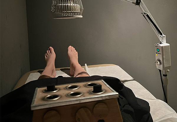 Person receiving Moxi Therapy at PULSE TCM