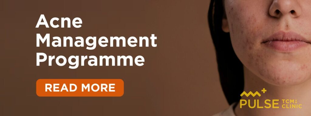 PULSE TCM Acne Management Programme